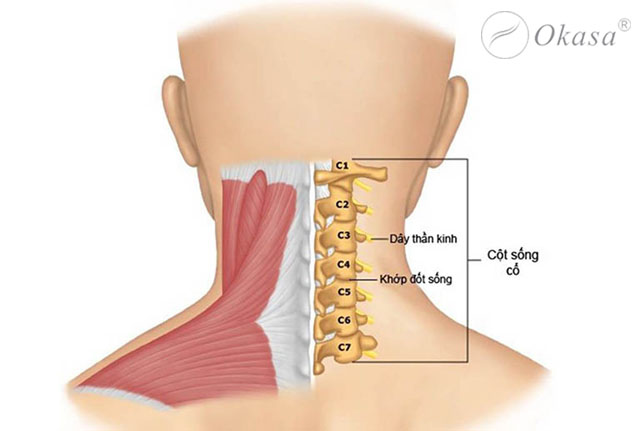 Triệu chứng và chẩn đoán thoái hóa đốt sống cổ