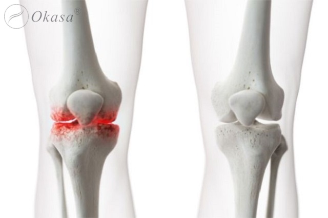 Ưu và nhược điểm các phương pháp điều trị xương khớp