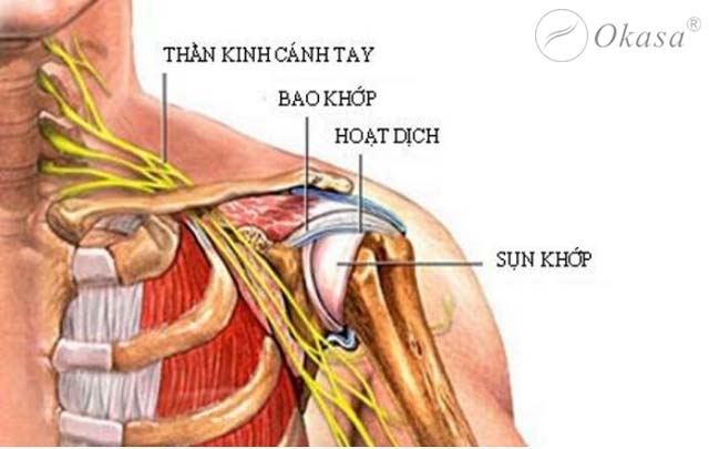 Viêm quanh khớp vai: Nguyên nhân và phương pháp điều trị