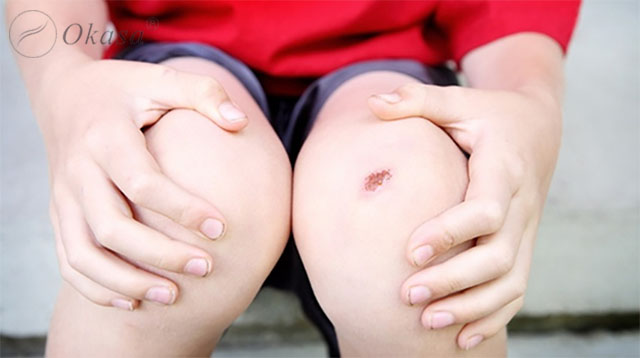 Xoa bóp bấm huyệt tốt cho người bệnh tiểu đường