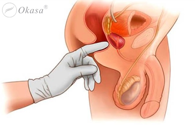 Xoa bóp bấm huyệt trị viêm tuyến tiền liệt